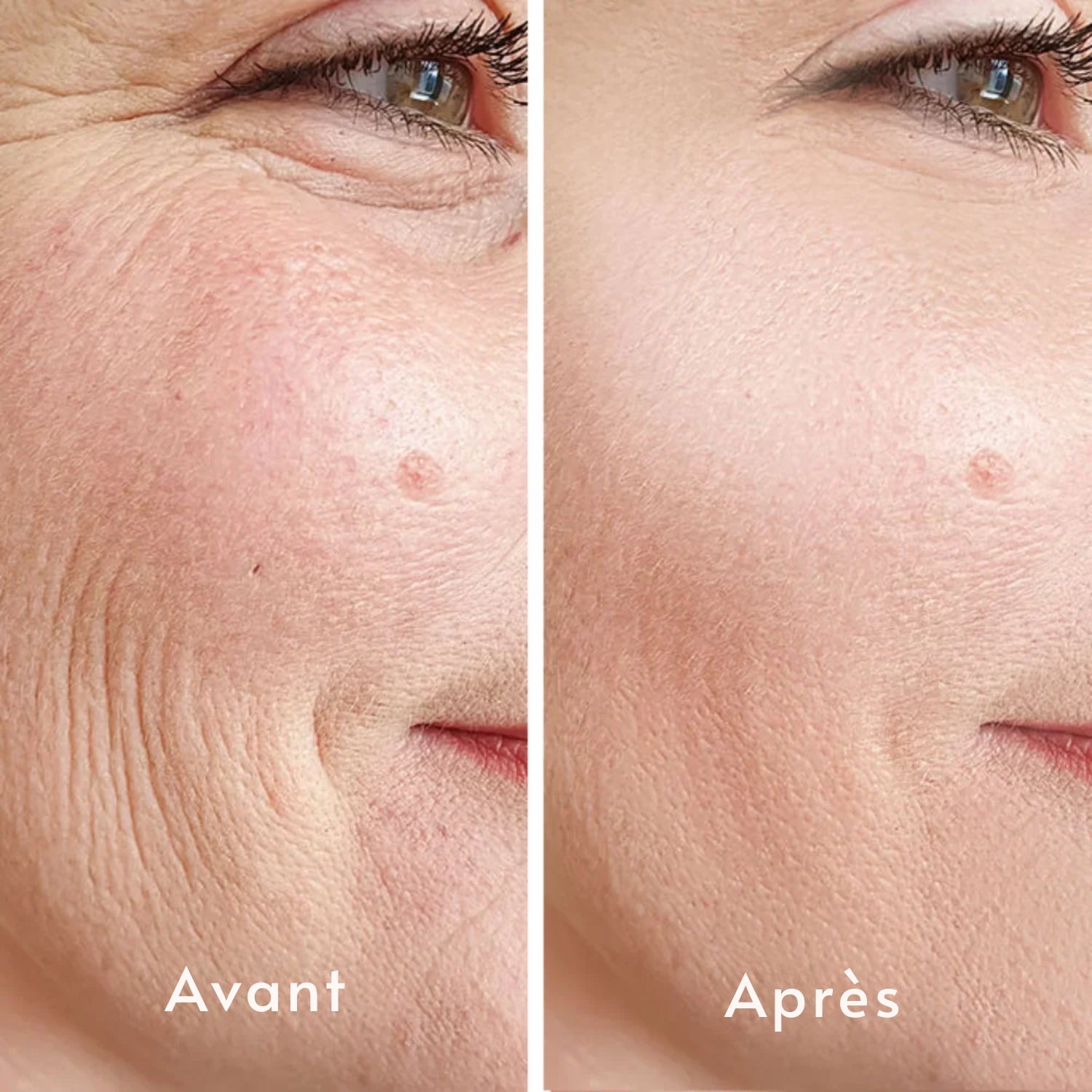 Masque au Collagène Apaisant et Profond