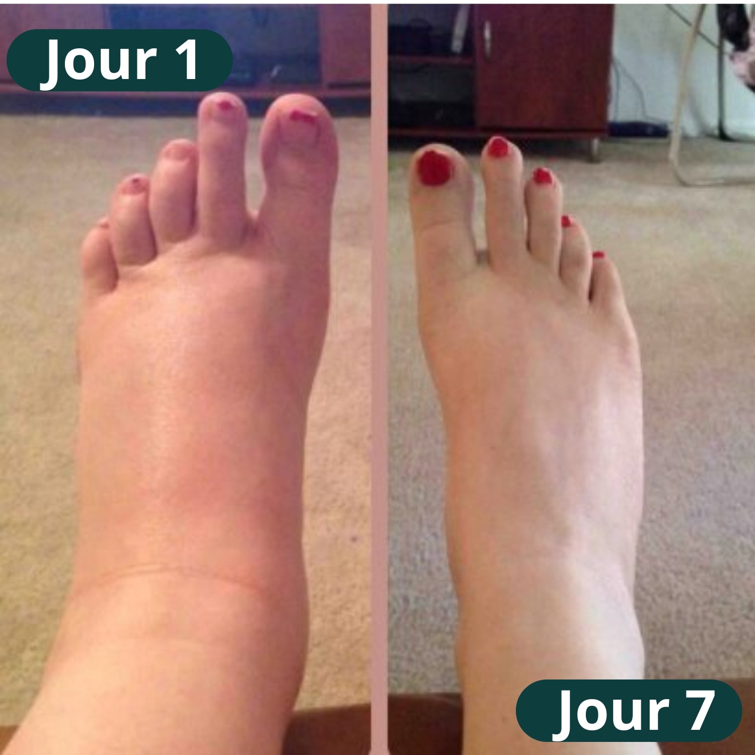 Nuvare | 3-en-1 Appareil De Massage Pour Les Pieds