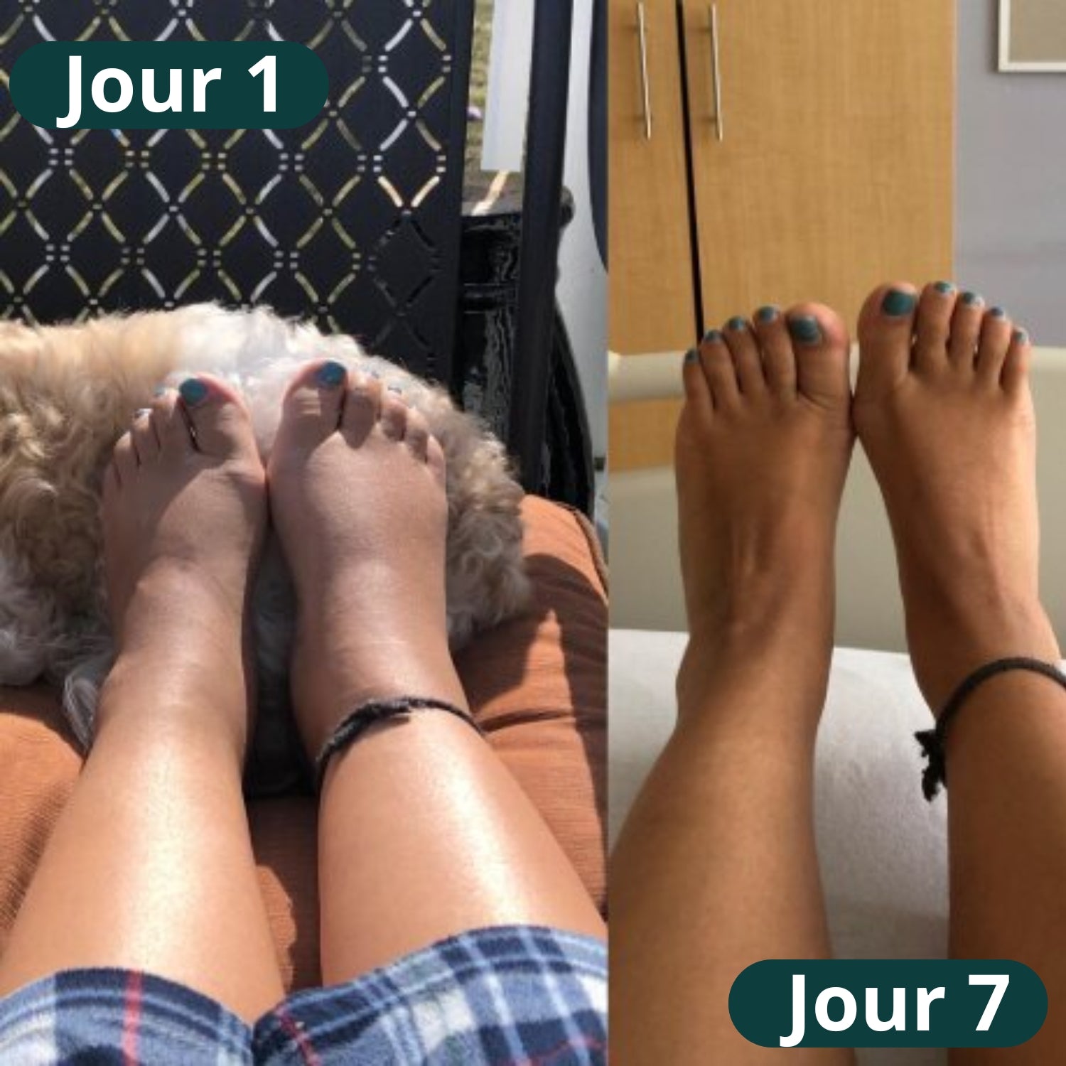 Nuvare | 3-en-1 Appareil De Massage Pour Les Pieds