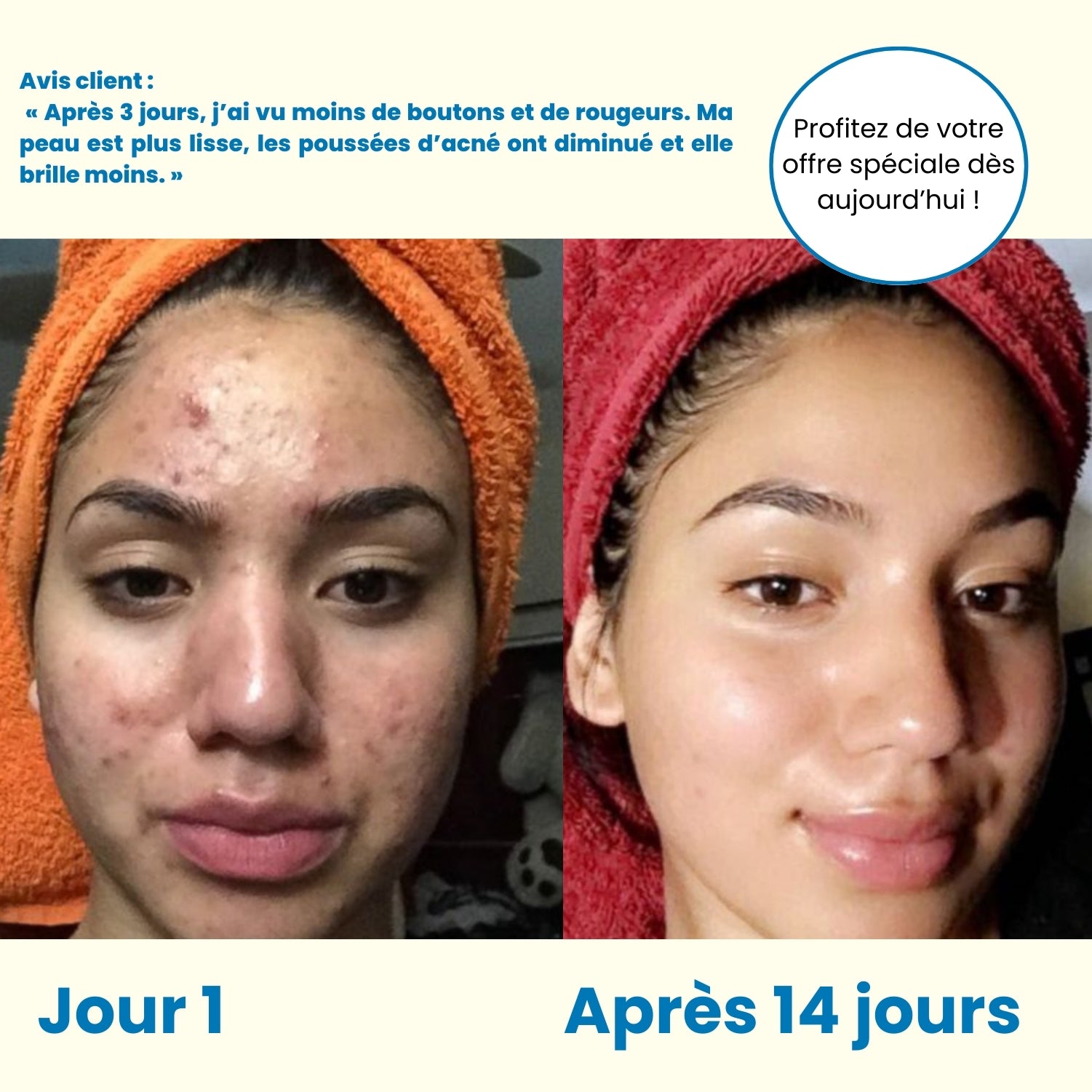 ClearSkin+