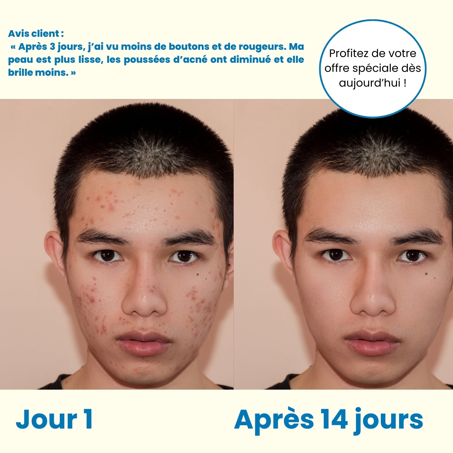ClearSkin+
