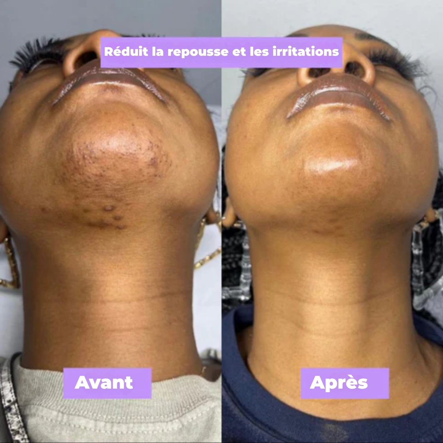 Nuvare | Cypherus Rotundus Skin Serum