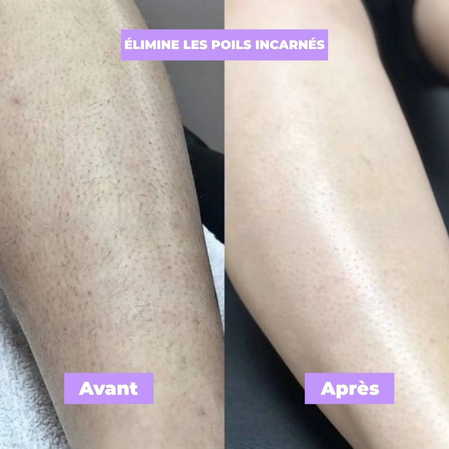 Nuvare | Cypherus Rotundus Skin Serum