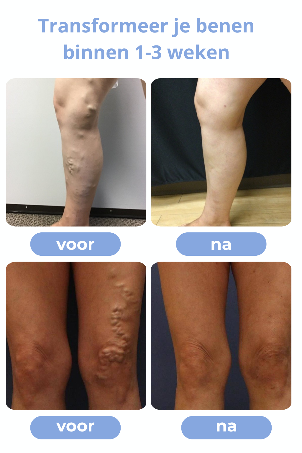 Séréniva™ | Spray Contre les Varices Visibles