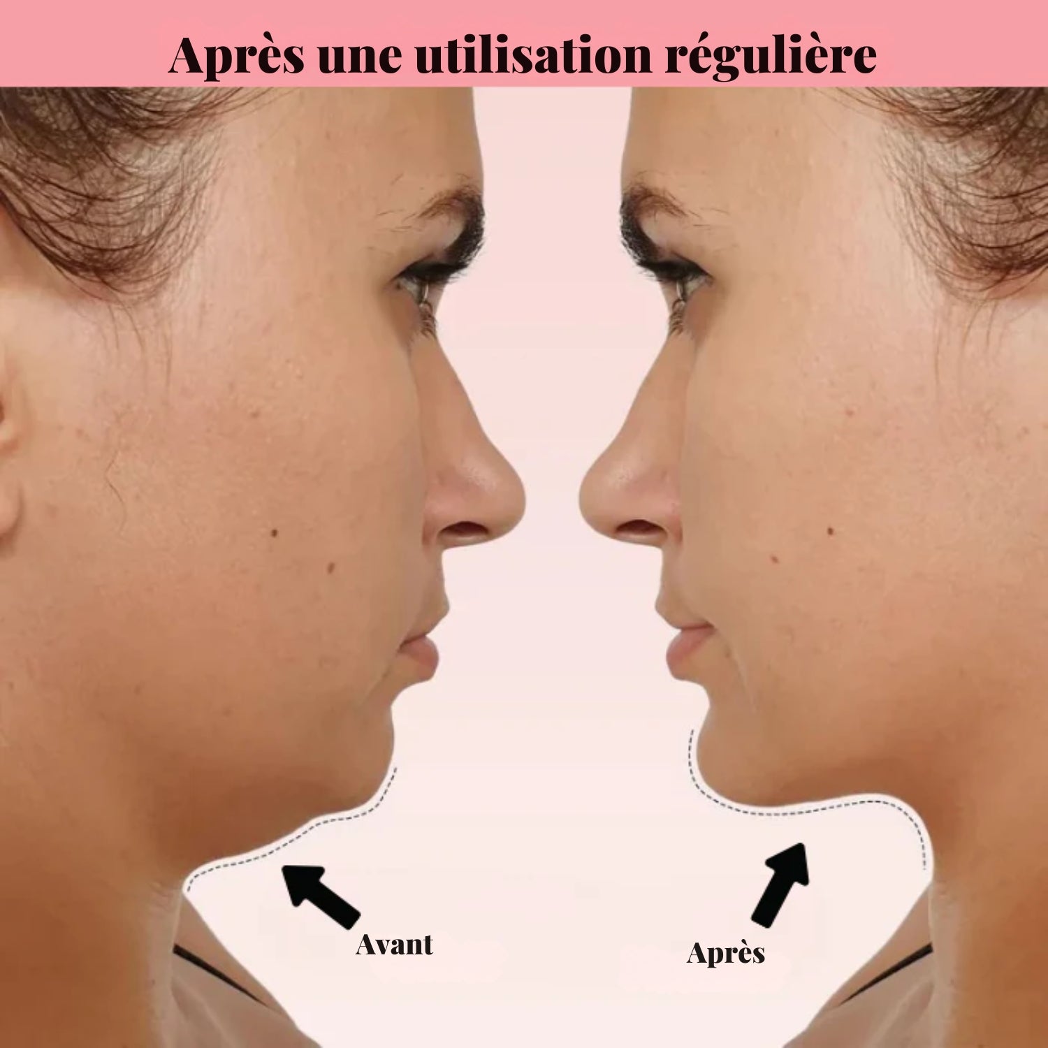 V-line mask
