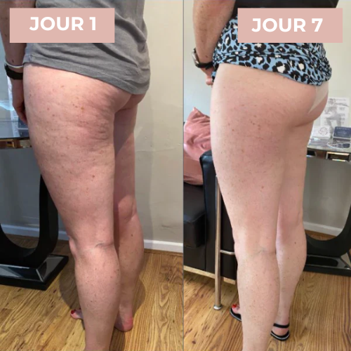 CuraBelle™ | Appareil de Massage pour le Soin de la Peau
