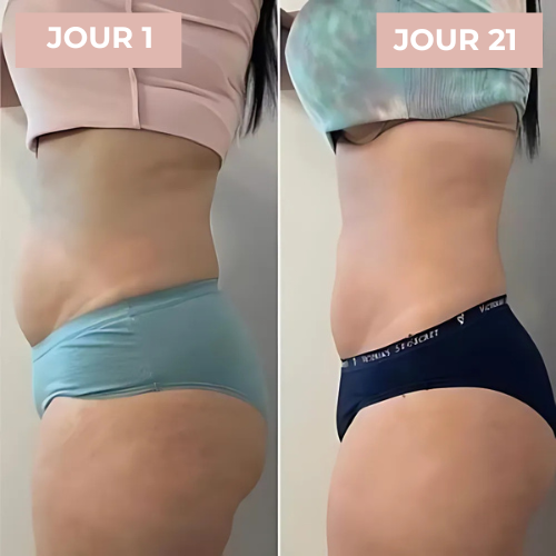 CuraBelle™ | Appareil de Massage pour le Soin de la Peau