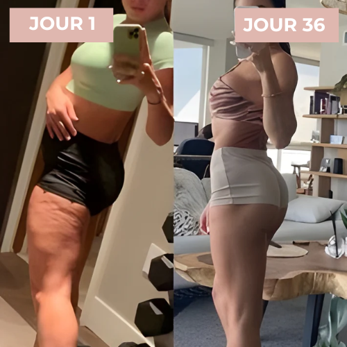 CuraBelle™ | Appareil de Massage pour le Soin de la Peau