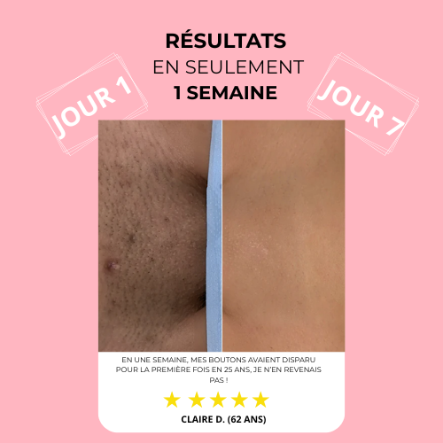 Barely™ | Le rasage le plus doux