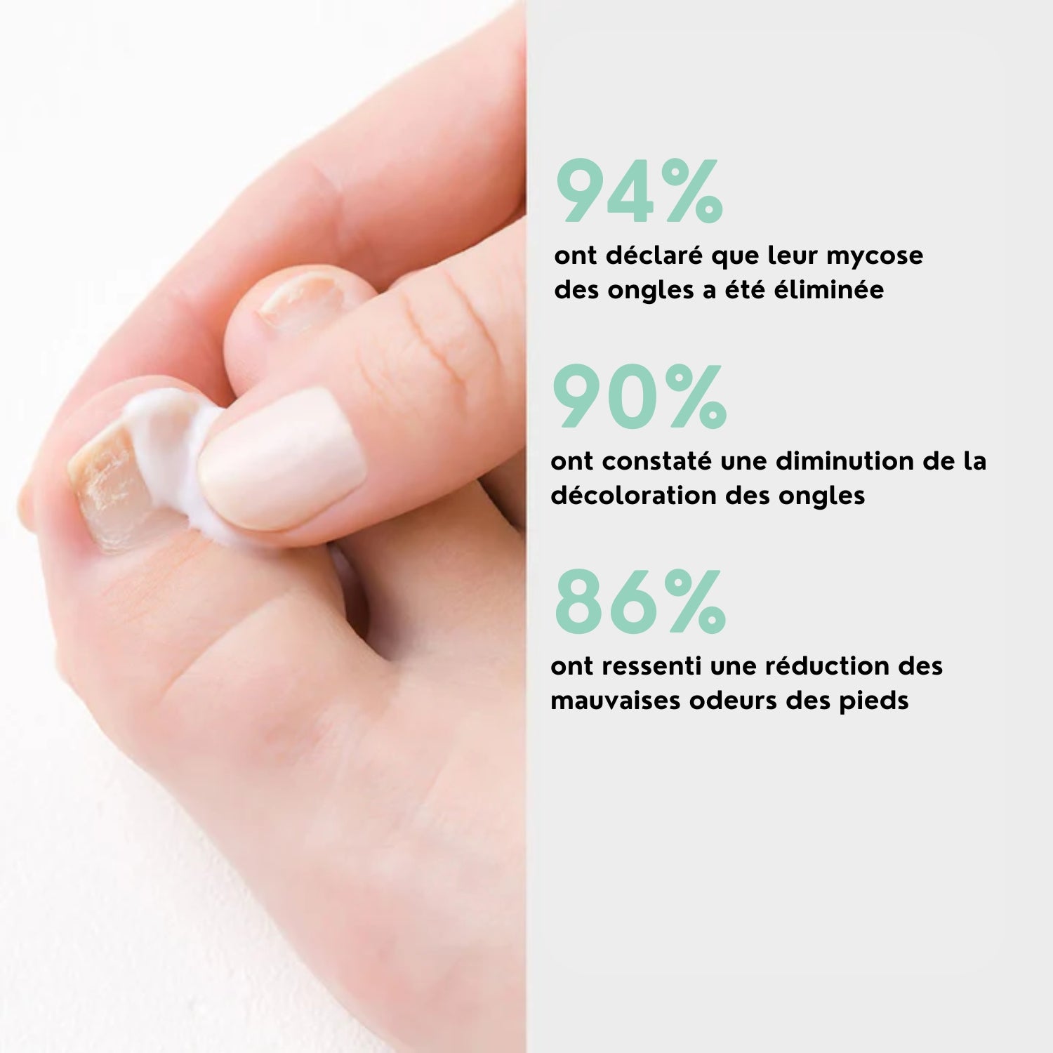 Nuvare | Gel traitant mycose des ongles