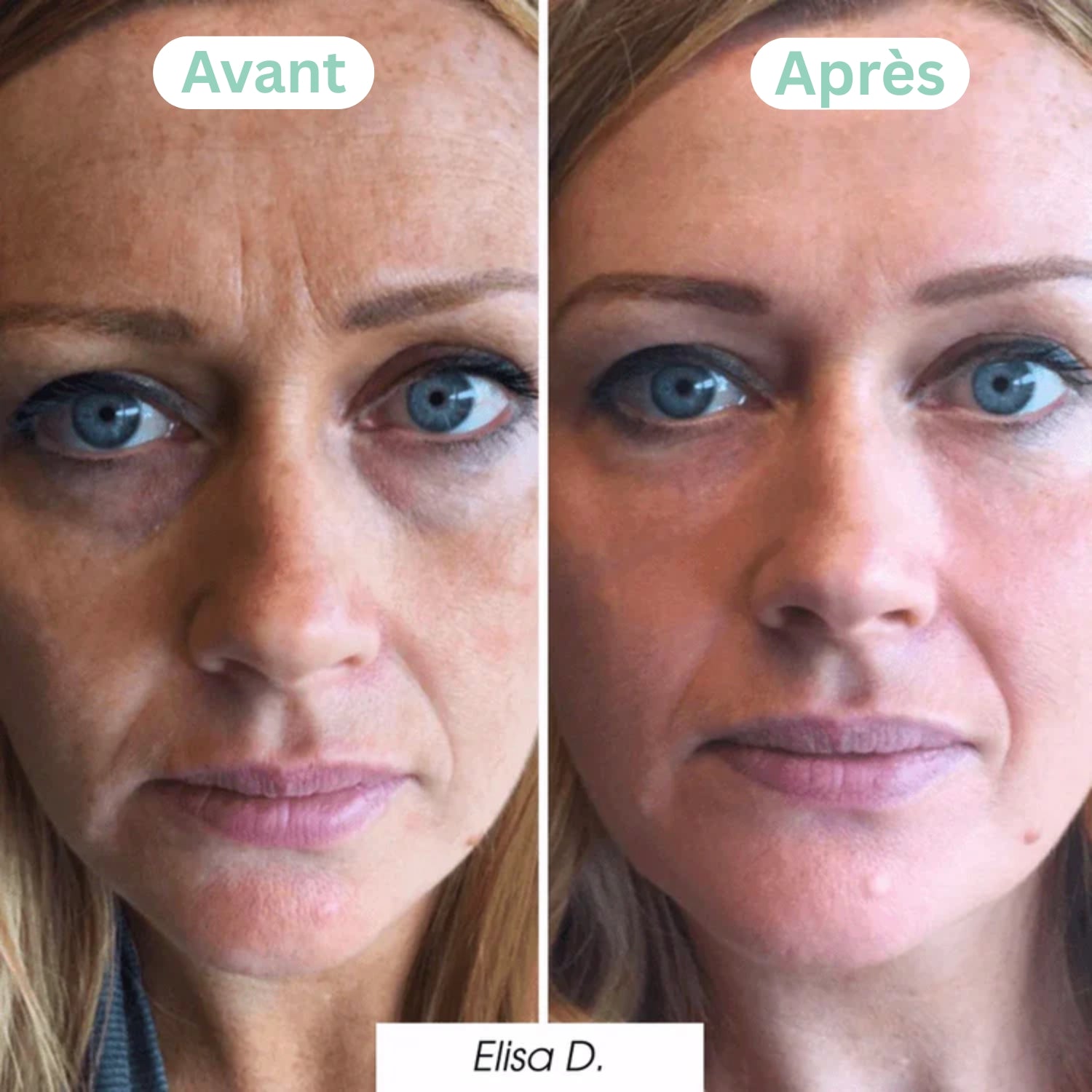 Nuvare Collagen Night Mask