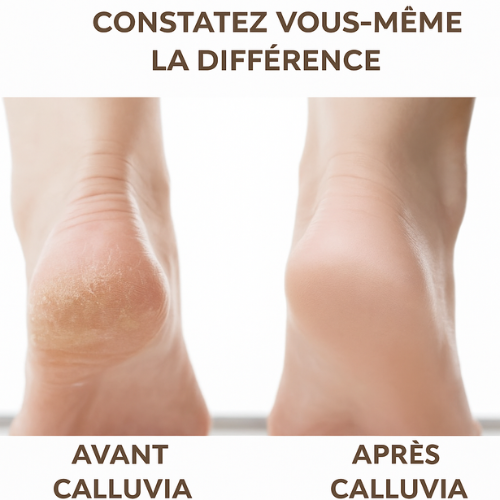 Calluvia™ | Adoucisseur de Pieds Électrique