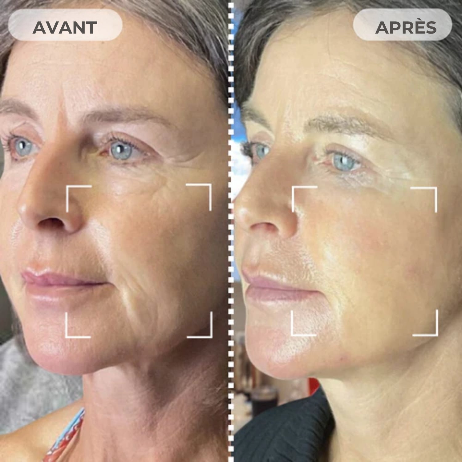 Nuvare™ |  Pro-Grade EMS Masque