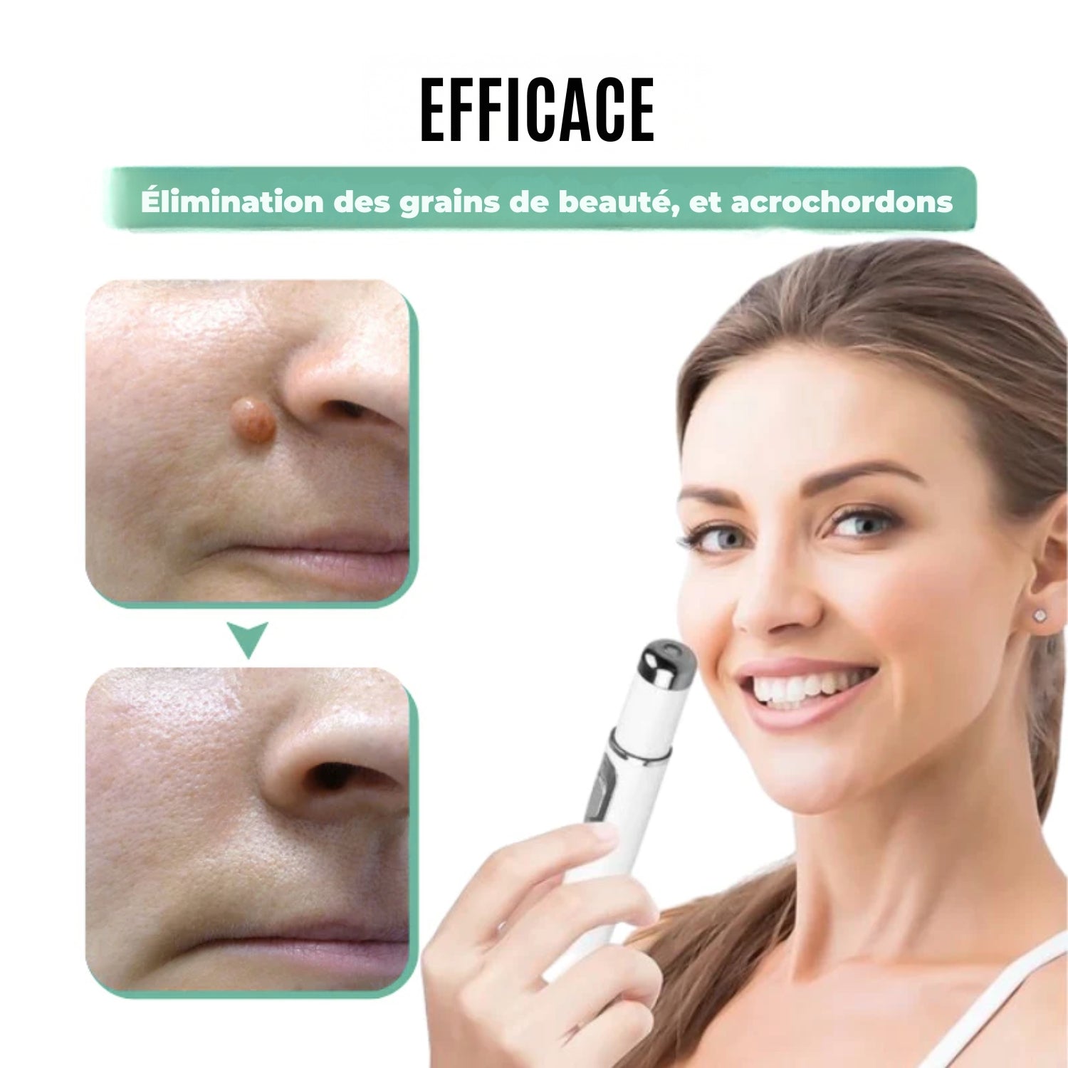 Nuvare | Élimination des grains de beauté, verrues & acrochordons