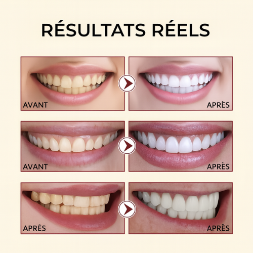 WhiteSmile™ – La force derrière un sourire éclatant.